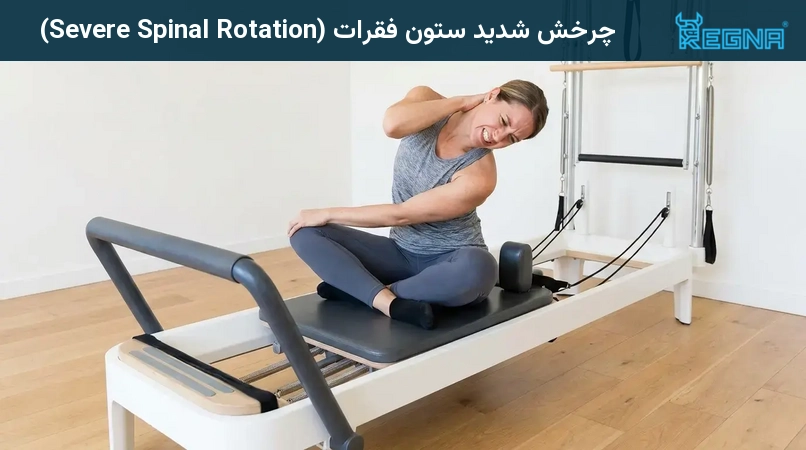 چرخش شدید ستون فقرات (Severe Spinal Rotation)